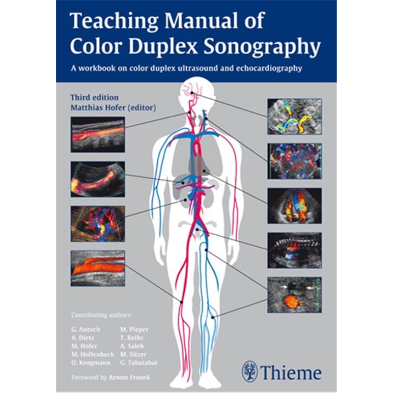 Teaching Manual of Color Duplex Sonography - A workbook on color duplex ultrasound and echocardiography